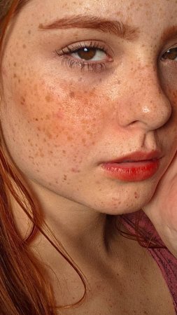 Beautiful freckles
